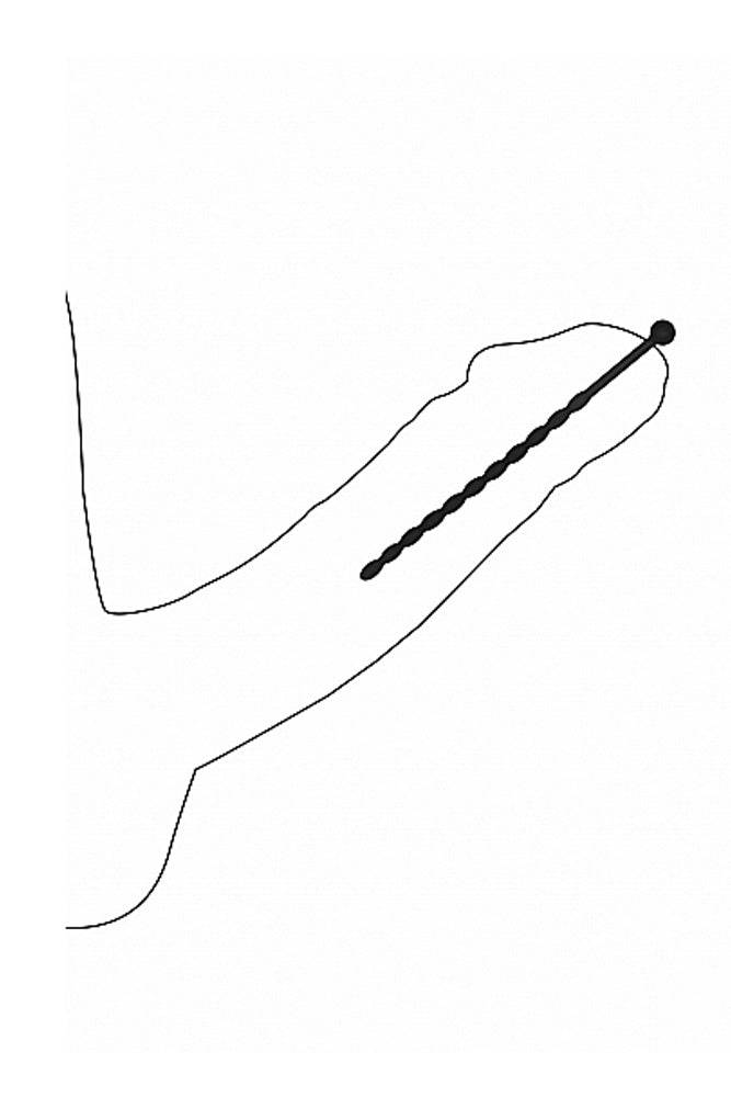 Ouch by Shots Toys - Beginner's Urethral Plug Set - Black - Stag Shop