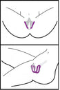 XR Brands - Frisky - Oral Enhancing - Hands Free Labia Spreader - Stag Shop