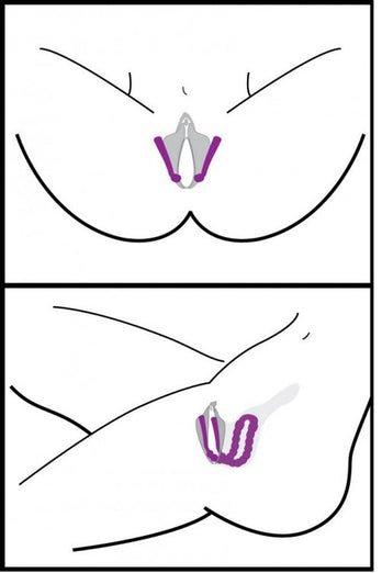 XR Brands - Frisky - Oral Enhancing - Hands Free Labia Spreader - Stag Shop