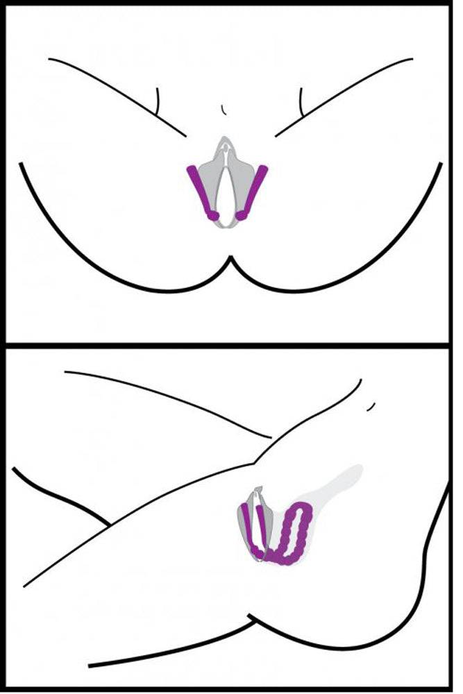 XR Brands - Frisky - Oral Enhancing - Hands Free Labia Spreader - Stag Shop