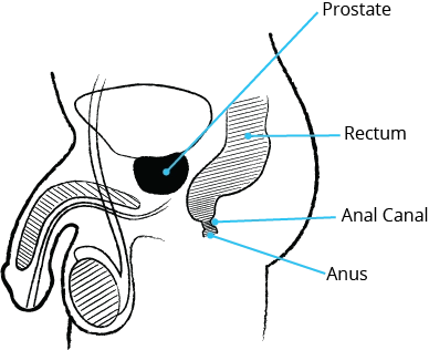 A diagram of the male anatomy showing the location of the prostate, rectum, anal canal, and the anus.